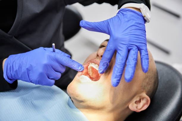 Best Chipped Tooth Repair Near Me  in Sutherlin, OR